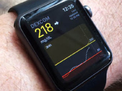 Apple Watch будут измерять уровень сахара