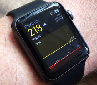 Apple Watch будут измерять уровень сахара