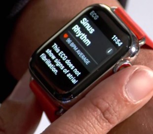 Apple предостерегла от чрезмерного использования функции ЭКГ в Apple Watch