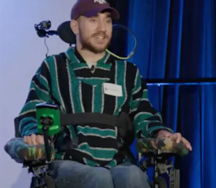 Втратив електроди, але почав перемагати в іграх: як живе людина з чипом Neuralink у мозку