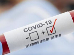 Результаты тестов на коронавирус 700 тыс. французов оказались в общем доступе