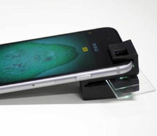 Распечатанная на 3D-принтере насадка превращает смартфон в полноценный микроскоп