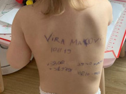 Мама написала контактну інформацію на тілі дворічної дочки: історія фото, що стало вірусним