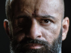 Масі Найєм опублікував відвертий портрет після тяжкого поранення (фото)