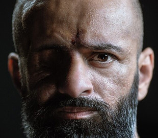 Масі Найєм опублікував відвертий портрет після тяжкого поранення (фото)