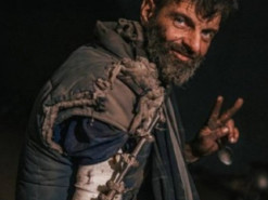 Ціна полону: захисник "Азвосталі" Михайло Діанов повернувся з полону без кістки в руці (фото)