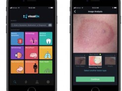 iPhone научили диагностировать кожные заболевания