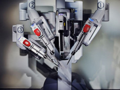 Впервые операцию на сердце сделали через интернет