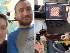Перший пацієнт Neuralink розповів, як живе з нейрочипом у мозку