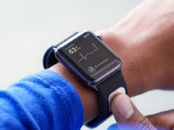 Apple Watch смогут сделать полноценную кардиограмму