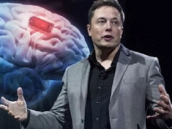 Компания Илона Маска предлагает транслировать музыку в мозг с помощью чипа