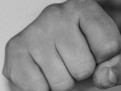 Зламали щелепу: в Ірландії фанати Путіна побили українського підлітка