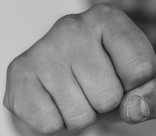 Зламали щелепу: в Ірландії фанати Путіна побили українського підлітка