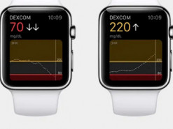 Смарт-часы Apple Watch Series 7 смогут отслеживать уровень сахара в крови
