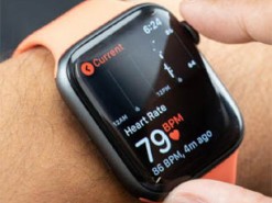 Apple Watch выявили аномалии в сердце и спасли жизнь человеку