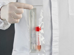 Apple пожертвовала $10 миллионов на разработку новых тестов на коронавирус