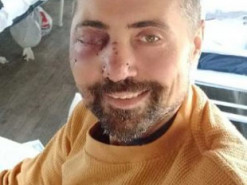 Актор Дмитро Лінартович вперше показався після важкого поранення у бою під Бахмутом