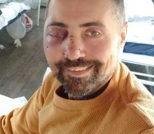 Актор Дмитро Лінартович вперше показався після важкого поранення у бою під Бахмутом