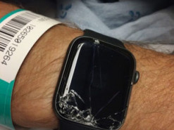 Apple Watch спасли жизнь человеку после падения с велосипеда