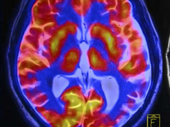 Ученые создали приложение для изучения мозга