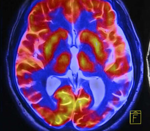 Ученые создали приложение для изучения мозга