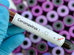 В Украине запустили онлайн-курс о коронавирусе