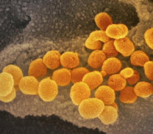 Программа, финансируемая Гейтсом, предложит домашние тесты на коронавирус