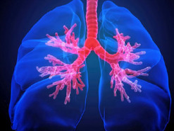 Искусственный интеллект точно предсказывает риск возникновения рака легких