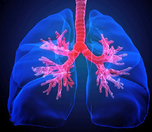 Искусственный интеллект точно предсказывает риск возникновения рака легких
