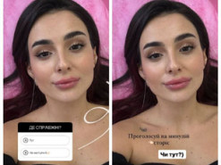 Анна Трінчер знову збільшила губи та порівняла фото до і після процедури