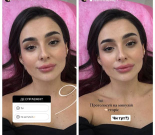 Анна Трінчер знову збільшила губи та порівняла фото до і після процедури