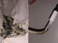 Заряжающийся iPhone загорелся на кровати, пока владелица спала