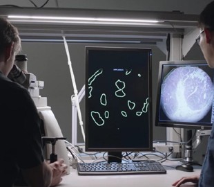 В Google создали микроскоп дополненной реальности для диагностики рака