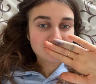 Jerry Heil дала перше інтерв’ю після падіння зі сцени