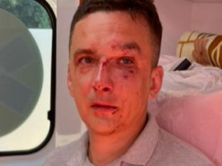 У Чернівцях посеред вулиці побили чоловіка. Нібито через дописи у соцмережах