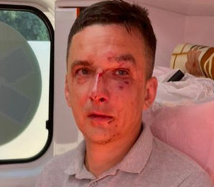 У Чернівцях посеред вулиці побили чоловіка. Нібито через дописи у соцмережах