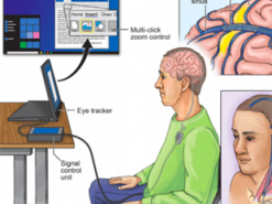 Ученые подключили мозг к компьютеру через вену