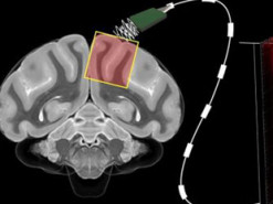 Учёные стали ближе к «чтению мыслей» без хирургического вмешательства в мозг