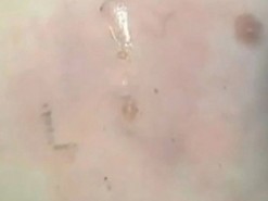 В руках школьника взорвался аккумулятор от iPhone