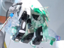 Как искусственный интеллект может улучшить протезы конечностей