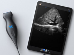 iPhone и ультразвук помогут диагностировать коронавирус удаленно