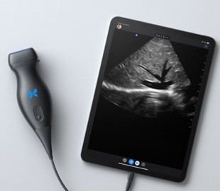 iPhone и ультразвук помогут диагностировать коронавирус удаленно