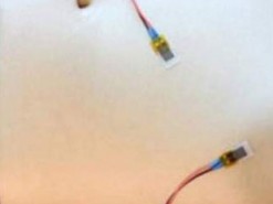 Умный пластырь спасет жизнь от приступов астмы