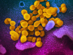 Ученые записали музыку коронавируса