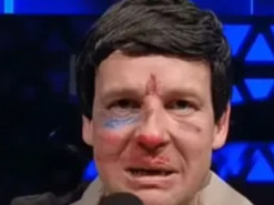 Зірка "Кварталу 95" потролив побитого Соловйова, який поскандалив з Пугачовою