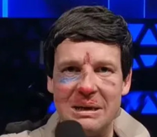 Зірка "Кварталу 95" потролив побитого Соловйова, який поскандалив з Пугачовою