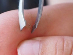 Як швидко та безболісно витягнути скалку: поради доктора Комаровського