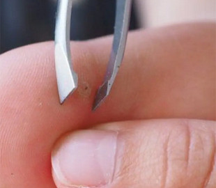 Як швидко та безболісно витягнути скалку: поради доктора Комаровського