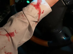 Lida Lee показалася у закривавленій блузці та пояснила, що трапилося