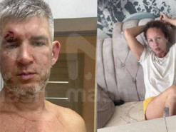 У Криму жінка мало не вбила чоловіка, який підтримав "спецоперацію" РФ